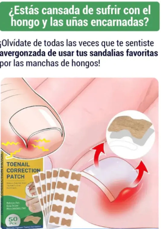 PARCHES PARA UÑAS ENCARNADAS DEL PIE